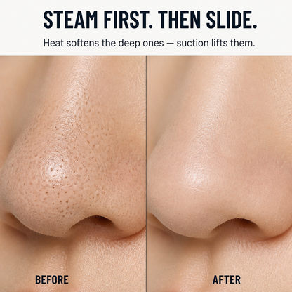 ClearVibe™ — Remove Stubborn Blackheads Without a Trace of Redness