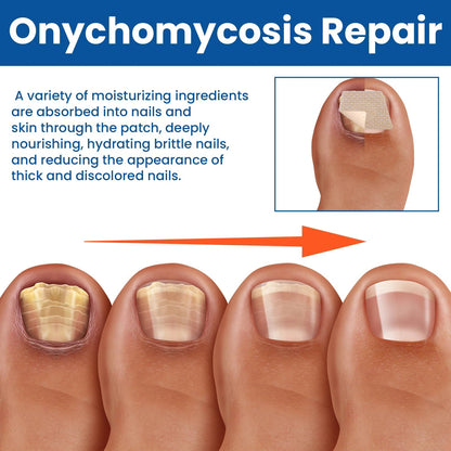 NailViveShield™ — Unleash Nail Confidence with Invisible, Powerful Healing