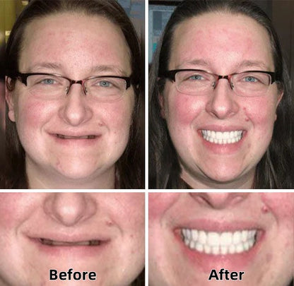 FlexDenta™ — Smile Freely Again with Dentures That Stay and Feel Real