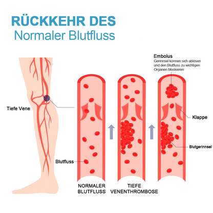 FormSocken™ — Smooth Legs, Boosted Energy Fast | 1+2 Free