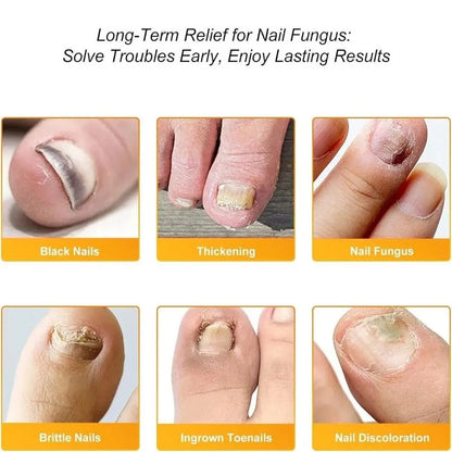 FungaGuard™ — Transform Your Nails Fast for Confidence That Shines Through