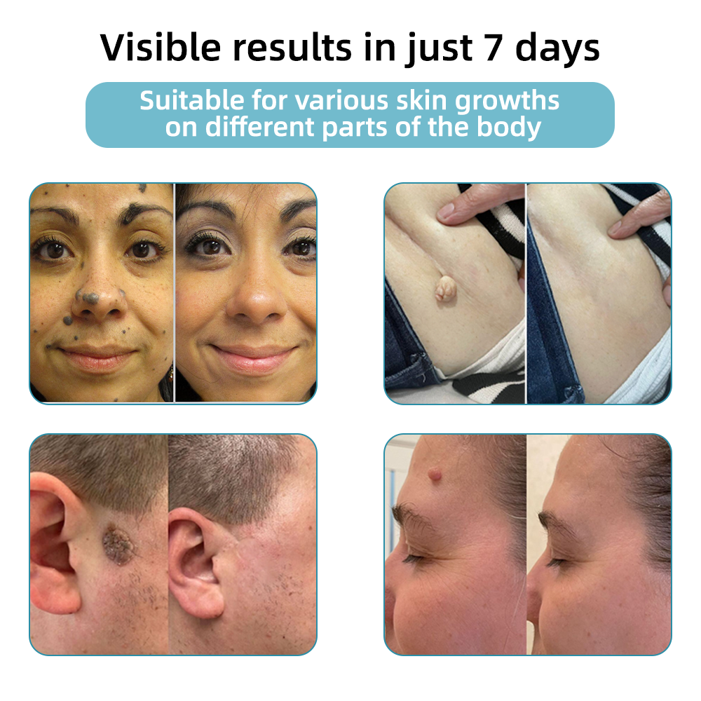 LuminaraTouch™ — Effortless Laser Precision for Radiant, Flawless Skin Fast