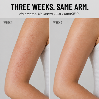 LumaSilk™ — Smooth Away Bumpy Arms, Bacne, and Strawberry Skin in 90 Seconds