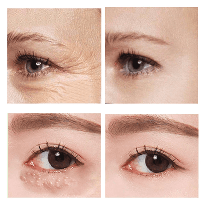1+1 Free | SleekEyes™ Rapid-Effect Firming Eye Cream