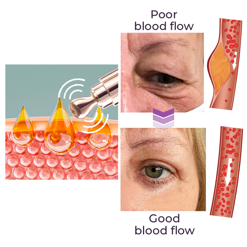 TheraPen™ Electric Serum Therapy Pen