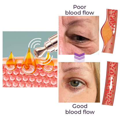 TheraPen™ Electric Serum Therapy Pen