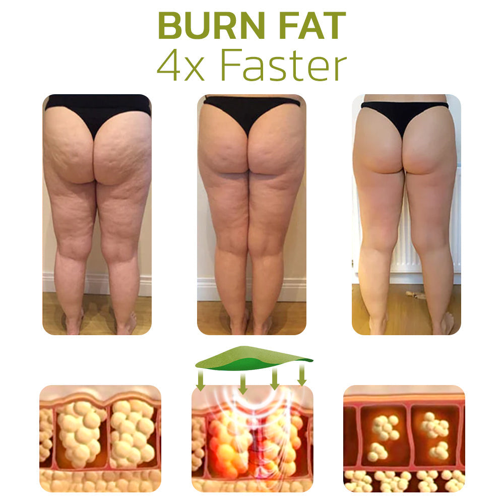 CelluSmooth™ Solution for Cellulite Reduction