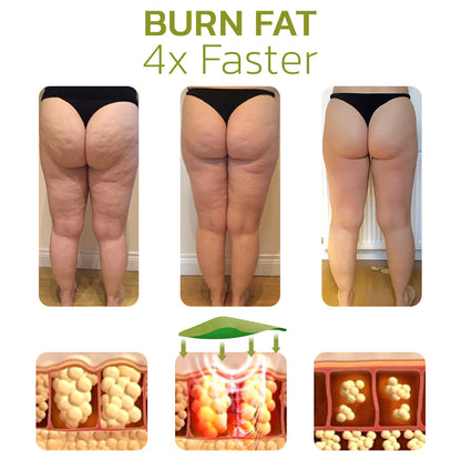 CelluSmooth™ Solution for Cellulite Reduction