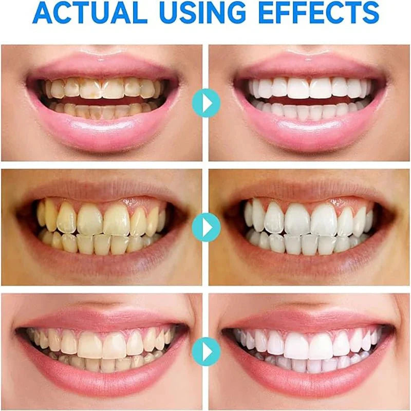 ClearSmile™ | Brighter Teeth, Healthier Gums, Fresher Mouth.