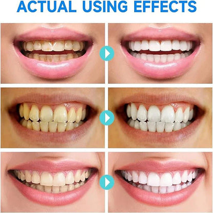 ClearSmile™ | Brighter Teeth, Healthier Gums, Fresher Mouth.