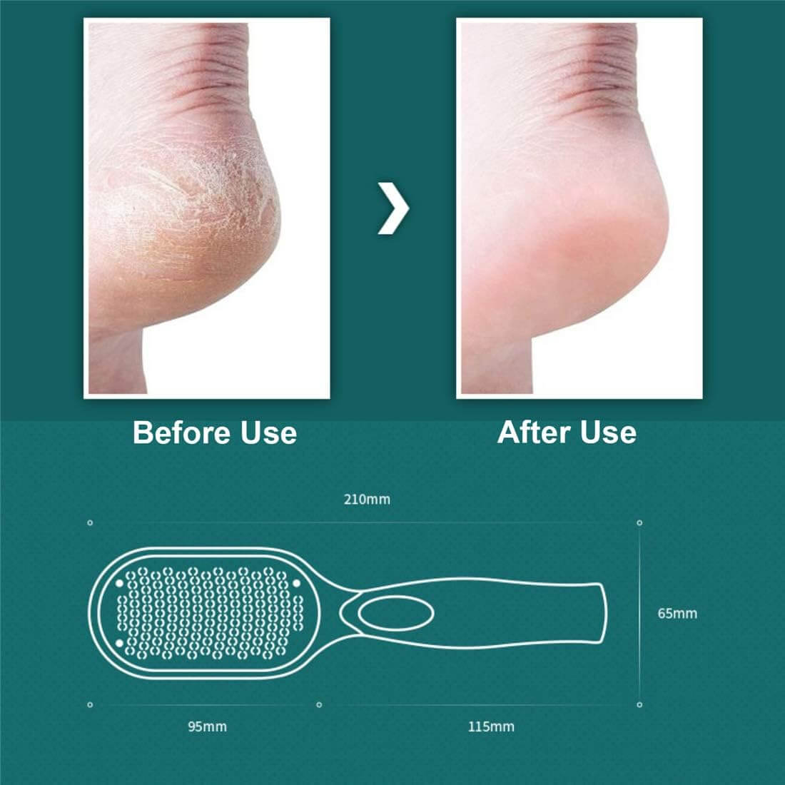 ProPeel Foot Callus Remover (55% Off on Final Day)