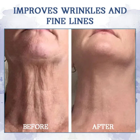 🥥𝐋𝐚𝐬𝐭 𝐃𝐚𝐲 𝐃𝐢𝐬𝐜𝐨𝐮𝐧𝐭: 𝟕5% 𝐎𝐅𝐅🫧 Advanced Fat-Burning & Firming Cream: Remove Excess Fat and Revitalize Skin Elasticity