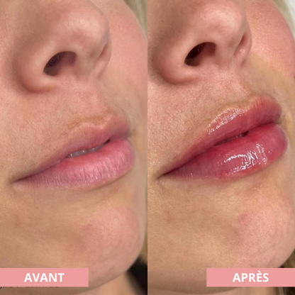 Arvilaro | Kit Ritual Lips - Thicker & Shiny lips in minutes
