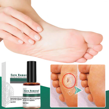 SilkStride™ — Melt Away Painful Calluses for Baby-Soft Feet You’ll Crave to Show