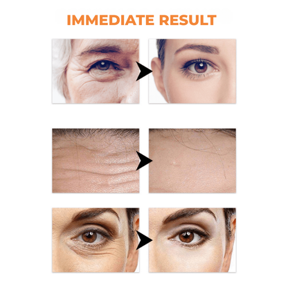 NovaLuxe™ Serum — Bounce Back Youthful, Radiant Skin in Days
