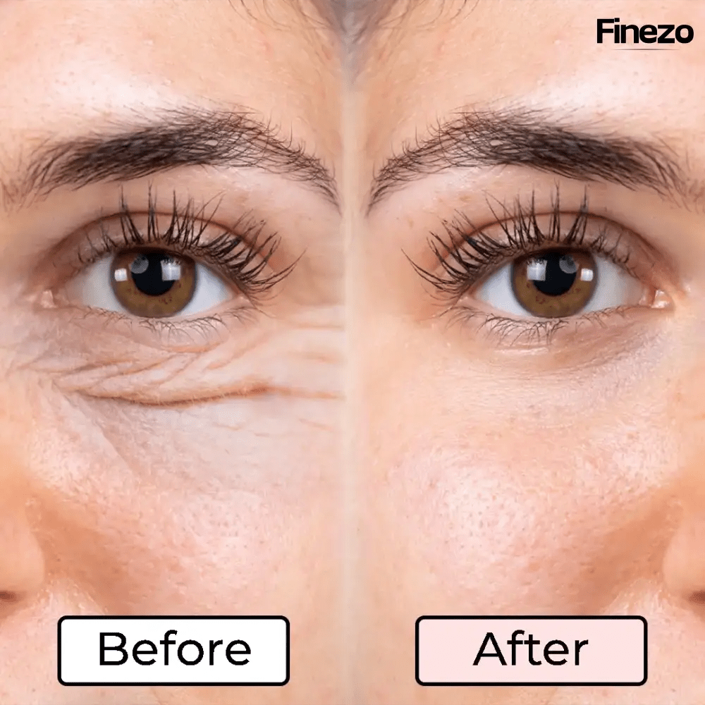 Glameyes™ | Eye Revitalizer – Achieve Radiant, Awake Eyes Free from Dark Circles! | 50% OFF