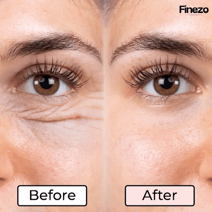 Glameyes™ | Eye Revitalizer – Achieve Radiant, Awake Eyes Free from Dark Circles! | 50% OFF