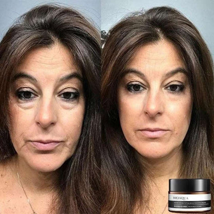 LumaRise™ Eye Renewal Cream — Wake Up to Instantly Younger, Brighter Eyes That Dazzle Every Day