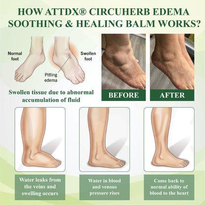 VascuRelief™ — Banish Swelling and Rediscover Effortless Freedom