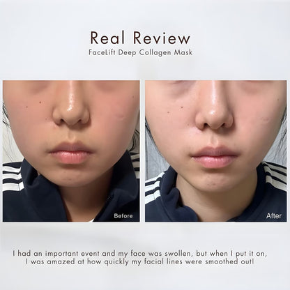 Mask for Lifting