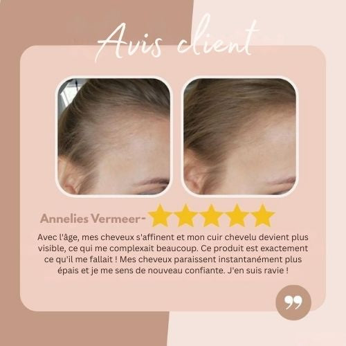 Reveluxe™ — Flawless, Full-Week Root Coverage That Boosts Your Confidence Instantly