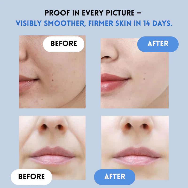 VelaLift™ — Instantly Lift, Hydrate, and Glow Like New Every Day
