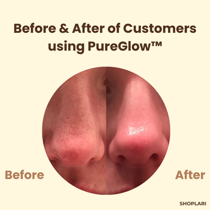1+1 Free | PureGlow Black Tea Mask™ Minimizes Wrinkles and Fine Lines for Youthful Skin