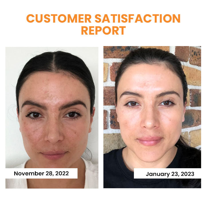 PurexaSkin™ — Reveal Firmer, Radiant Skin That Feels Youthfully Plump Every Day