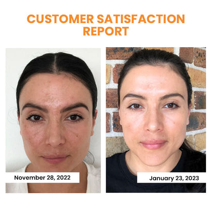 PurexaSkin™ — Reveal Firmer, Radiant Skin That Feels Youthfully Plump Every Day