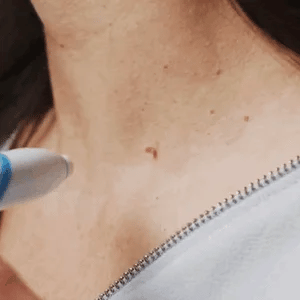 ClearPulse™ — Reveal Your Smoothest, Tag-Free Skin Without Pain or Hassle