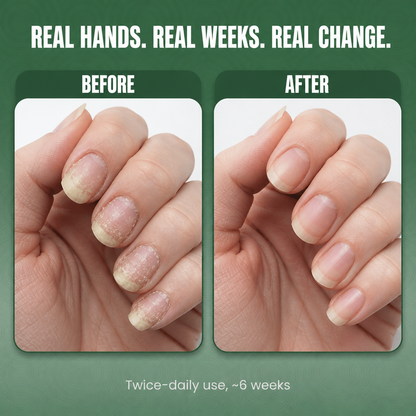 LumeNail™ — Watch Your Nails Transform from Weak to Wow with Pure Plant Power