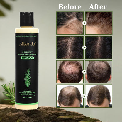 Follicraze™ Shampoo — Awaken Your Scalp for Thicker, Irresistible Hair Every Day