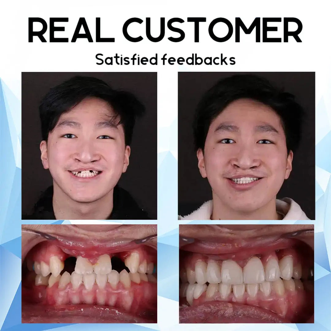 RamiraSmile™ — Unlock Unshakable Confidence with Effortless, All-Day Comfort