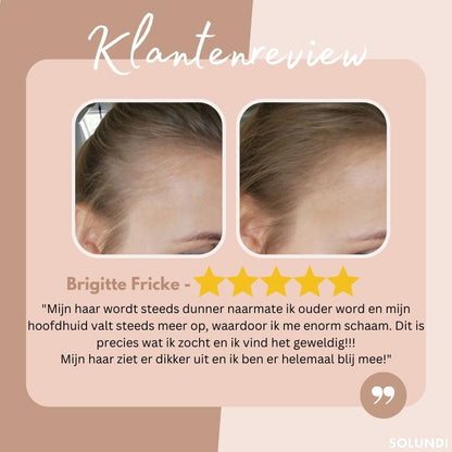 EasyBlend - Bye-Bye Hairline | 1+1 FREE ONLY TEMPORARILY