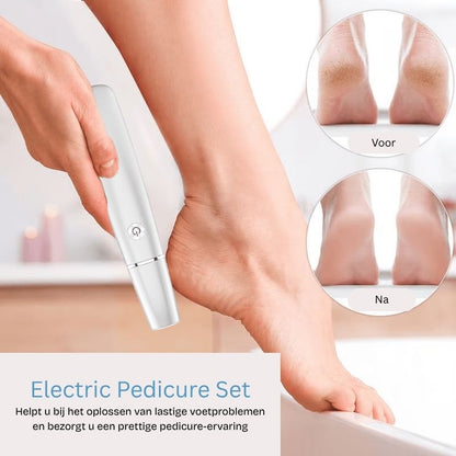 FootRenew™ - Eliminate Painful Calluses with Professional-Grade Strength and Comfort