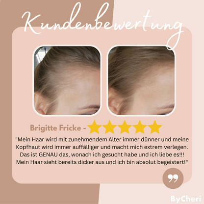 EasyBlend™ — Instantly Fuller, Natural Hairlines | 1+1 Free