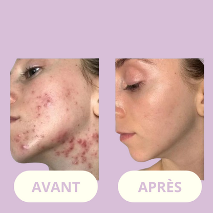 ClarityWand – For Smooth, Spotless Skin