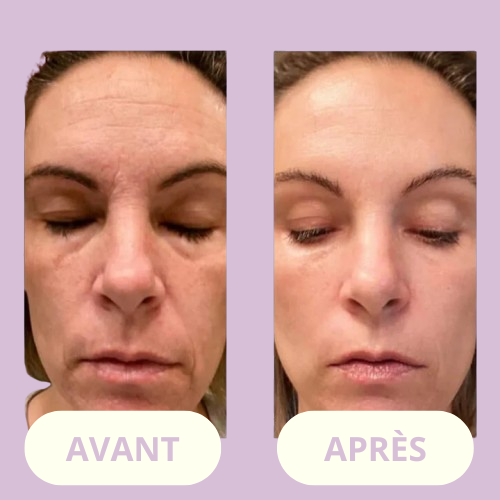 ClarityWand – For Smooth, Spotless Skin