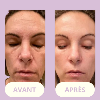 ClarityWand – For Smooth, Spotless Skin