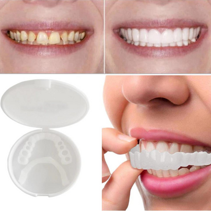 SnapSmile™ — Unlock Instant Confidence & Shine | 50% Off