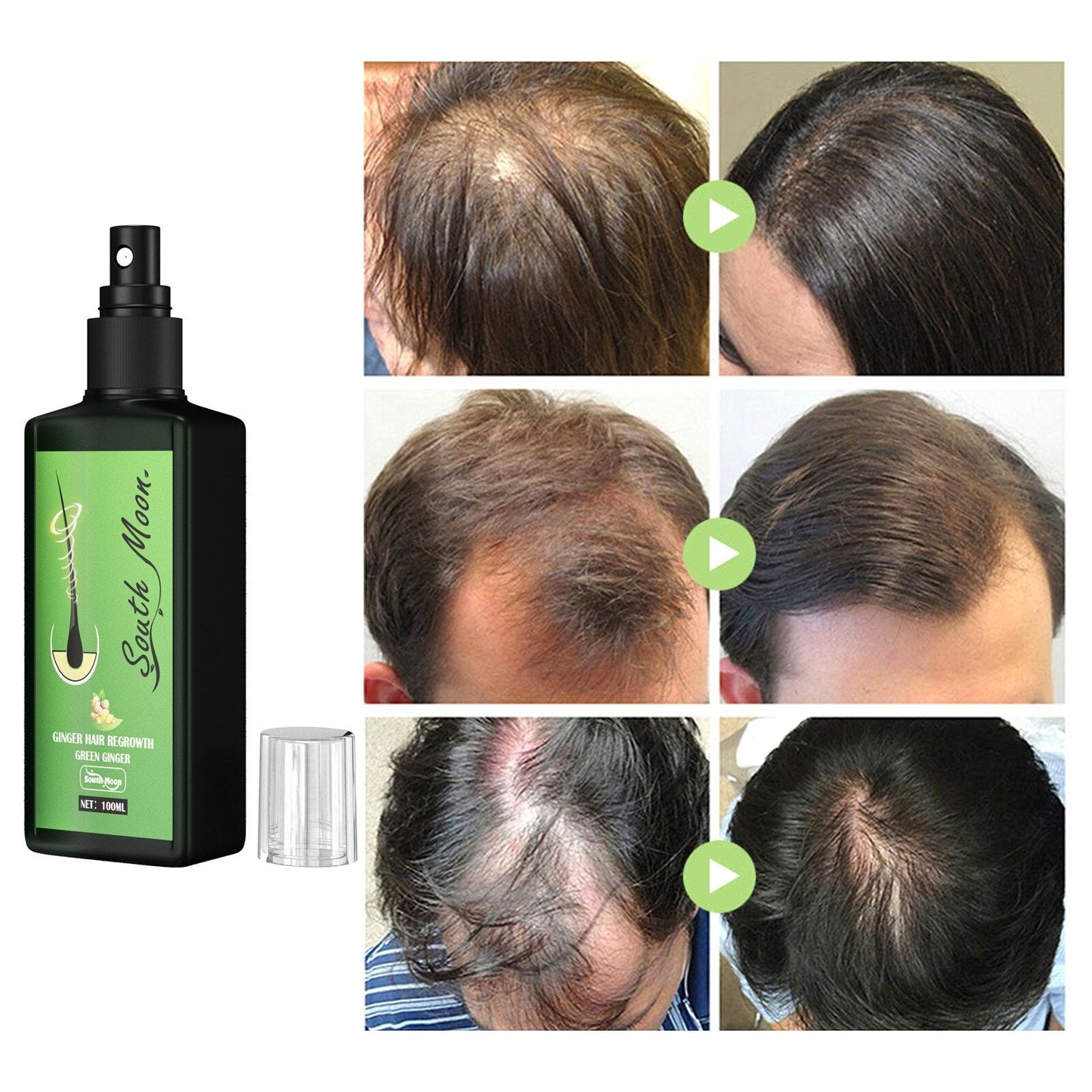 GrowthPlus™ — Thicker, Fuller Hair Fast | 50% Off