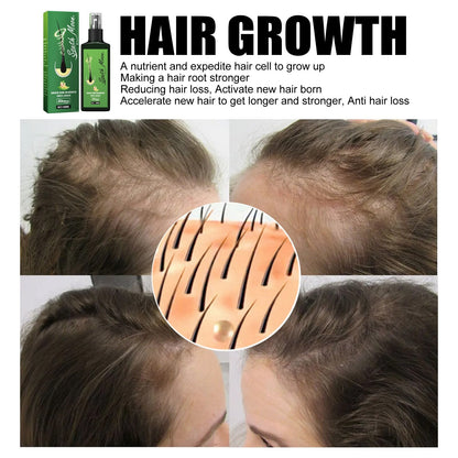 GrowthPlus™ — Thicker, Fuller Hair Fast | 50% Off