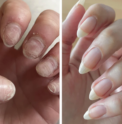 Pure Nail Serum | Almalys Nail Serum