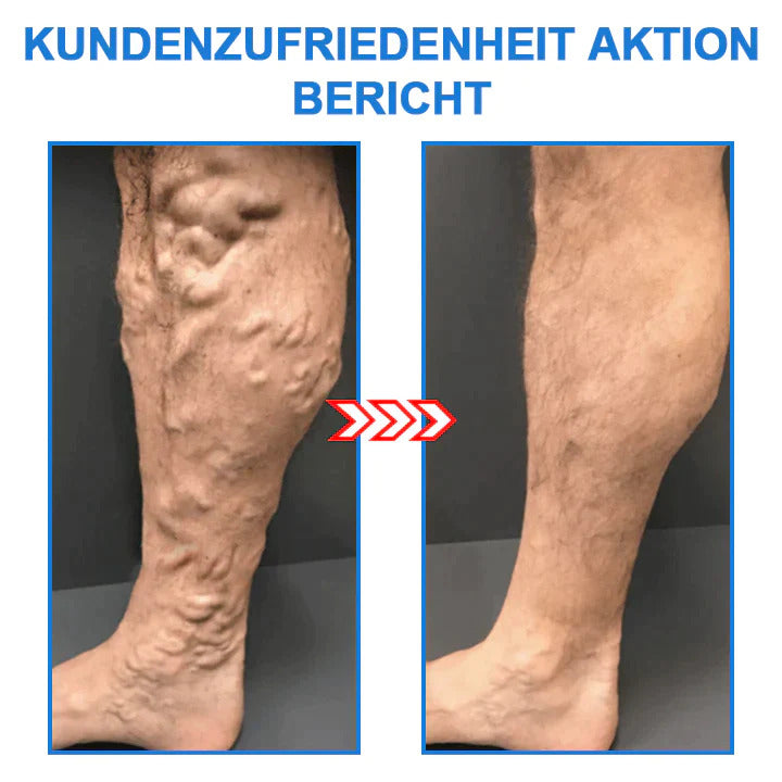 FormSocken™ — Smooth Legs, Boosted Energy Fast | 1+2 Free