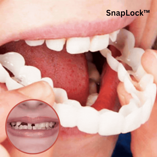 SnapLock™ Snap-In Dentures (50% Off Today Only)