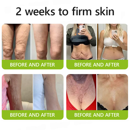 LuminaLift™ — Instantly Reveal Firmer, Brighter Skin That Turns Back Time Without Needles