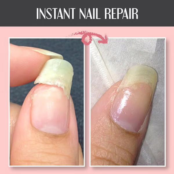 RevitaNail™ — Instantly Repair and Strengthen Nails for a Dazzling, Confident Glow