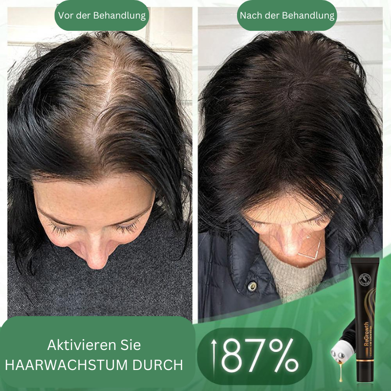 HairBoost™ Bio Hair Serum Roller (Purchase 1 Get 1 Free)