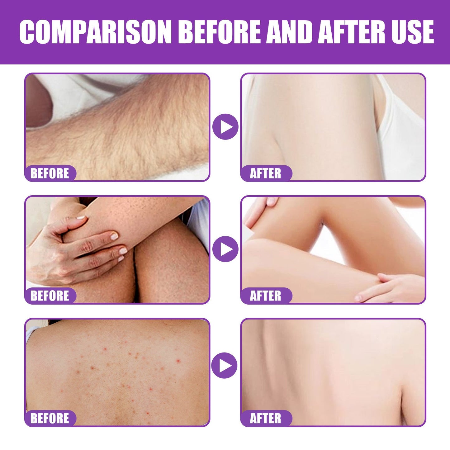 LumiDare™ Crystal Dermabrasion Tool — Experience Silky-Smooth Skin and Effortless Confidence Every Day