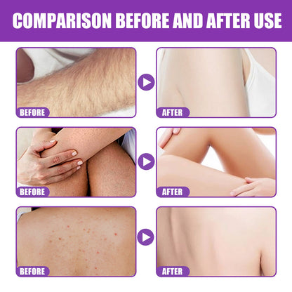 LumiDare™ Crystal Dermabrasion Tool — Experience Silky-Smooth Skin and Effortless Confidence Every Day